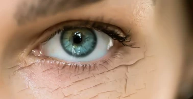 Göz kuruluğunun gerçek nedeni  bakın neymiş