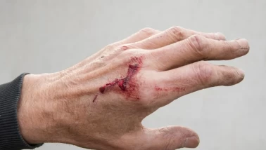 Yara ve çiziklere iyi gelen doğal krem!