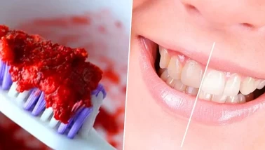 Diş temizliğinde doğal çözüm arayanlara özel!