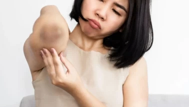 Diz ve dirseklerdeki koyulaşmaya pratik çözüm!