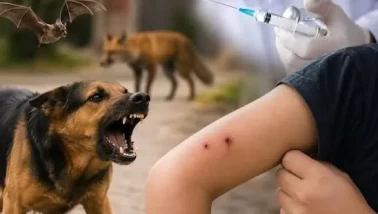 Kuduz tehlikesine karşı kritik detay!