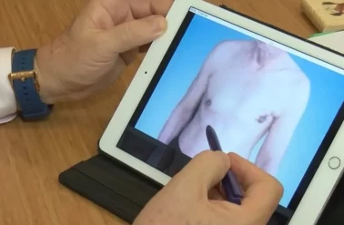 Meme kanseri belirtisi olabilir