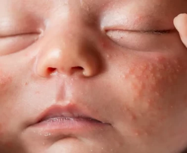 Hangisi normal, hangisi değil?