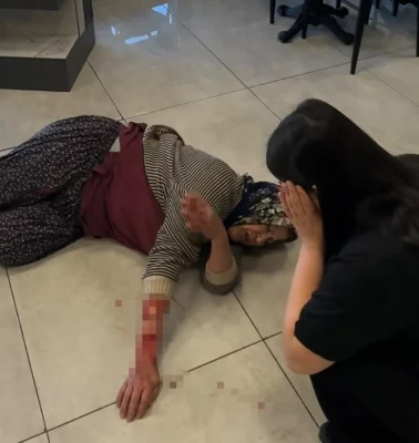 Dinlenme tesisinde dehşet! Başıboş köpek kadının kolunu kopardı