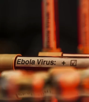 Ebola salgını KDC'de 1 milyon kişiyi daha yoksulluğa sürükleyebilir