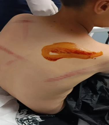 11 yaşındaki çocuğa sopayla öldüresiye dayak!