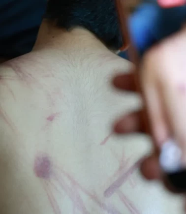 Rehabilitasyon merkezinde şiddet! Olayla ilgili soruşturma başlatıldı