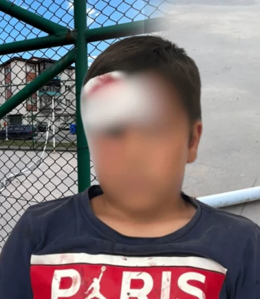 Bolu’da oyun parkında korkunç ihmal