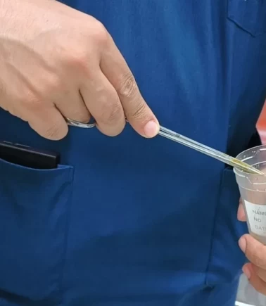 Yutkunamayan adamın boğazından canlı sülük çıkarıldı!
