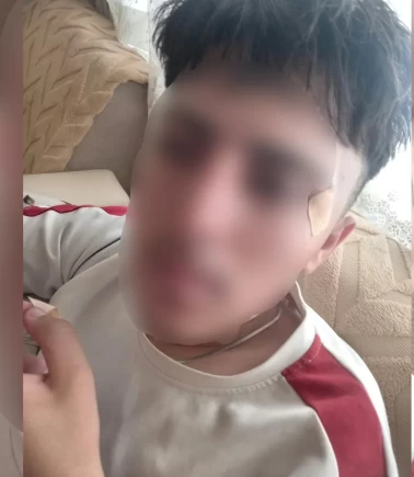Öğretmenin kafa attığı öğrenci kanlar içinde kaldı