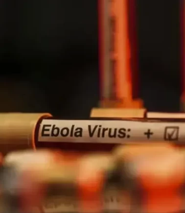 Nijerya'da ilk Ebola virüsü vakası tespit edildi
