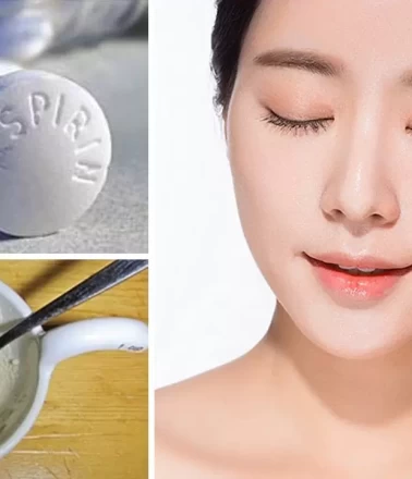 Sivilcelere karşı aspirin maskesi nedir?