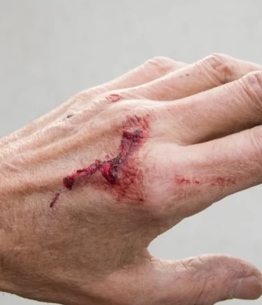 Yara ve çiziklere iyi gelen doğal krem!