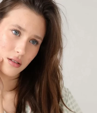 Yüzdeki lekeler için ev yapımı maske!