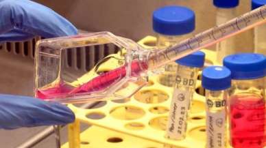 Önce laboratuvarda deneniyor! Bu çalışma kanseri can evinden vuracak