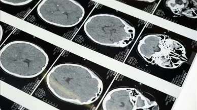 Uzmanlardan masajla gelen inme uyarısı