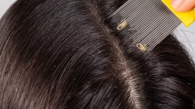 Sebebi bakın neymiş