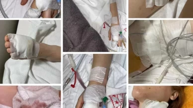 Erkek şiddeti bitmiyor! Üç gün önce uzaklaştırma talebinde bulunan mağdur kadın 11 yerinden bıçaklandı