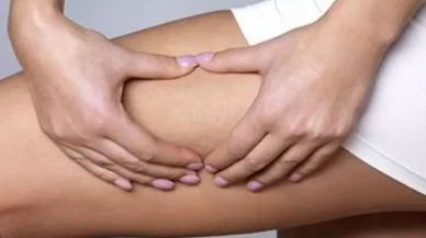 Selülitleri yok eden 6 basit egzersiz