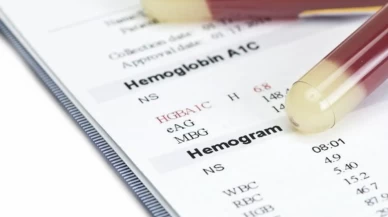 Bu 4 kan değerini dengeleyin