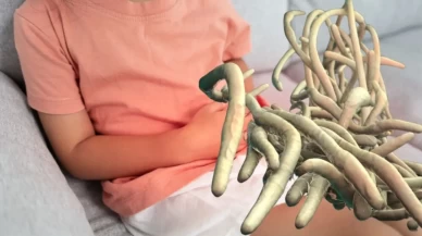 Doğal tedaviyle 10 günde kurtulun