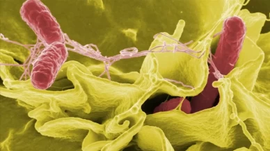 Gıda kaynaklı bakteriye dikkat! Mide bulantısı, kusma ve yüksek ateşle kendini gösteriyor