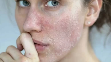 Kışın yüzünüzü böyle yıkayın