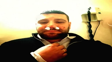 Ankara’da trafik kavgasında avukatın burnu kırıldı