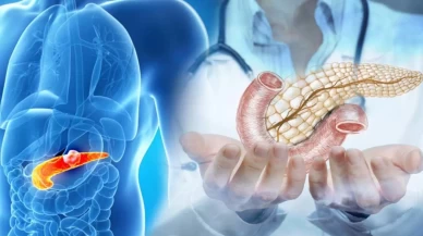 "Sigara ve obezite pankreas kanseri riskini artırıyor"