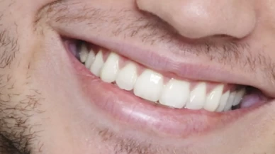 Uzmanlardan mutfak tavsiyesi