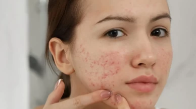 Arı reçinesi maskesi