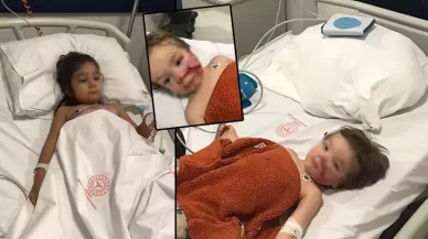 Pitbull, iki küçük kardeşe saldırdı