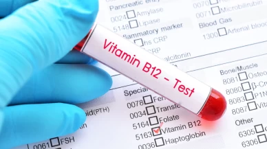 B12 fazlalığı nedir, neden olur?