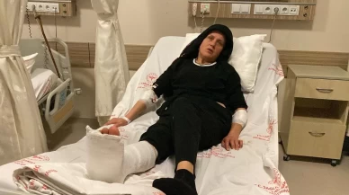 Karabük'te köpek saldırısında bir kadın yaralandı