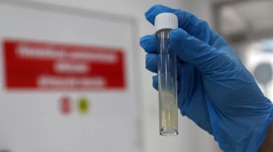 Tüberküloz hastalarına yakın takip