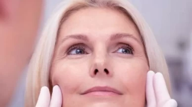 HIFU nedir? Yüz germe için devrim niteliğinde yöntem