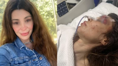 İş görüşmesine gitti, kâbusu yaşadı! Genç kadın yoğun bakımda yaşam savaşı veriyor