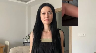 Solaryumda mahsur kaldı, yanıklar oluştu...