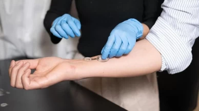 Enfeksiyonları günler öncesinden tespit eden akıllı bandaj