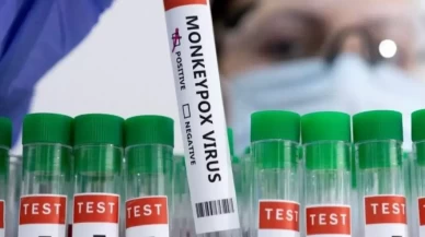 Liberya'da M çiçeği vaka sayısı 78'e yükseldi