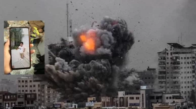 5 Yaşındaki Usame’nin öncesi ve sonrası fotoğrafları tüm dünyayı sarstı