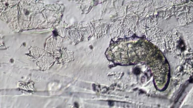 Siz uyurken yüzünüzde yaşayan canlılar iş başında olabilir