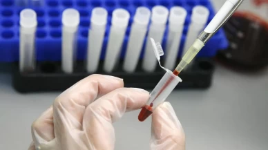 HIV tedavisinde tarihi adım!