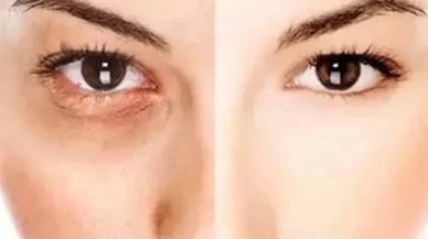 Yaşlanmaya meydan okuyan gençlik sırları