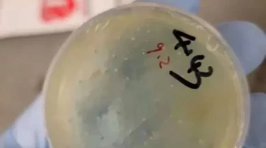 Gizli biyolojik madde skandalı