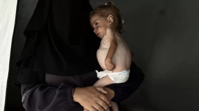 Gazze'de 2 yaşındaki Filistinli bebek yaşam mücadelesi veriyor