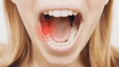 Diş Ağrısına Ne İyi Gelir?
