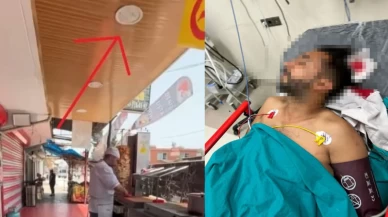 Dürüm yerken başından vuruldu!