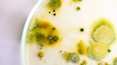 Küflenmiş yoğurt maskesinin faydalarına inanamayacaksınız!