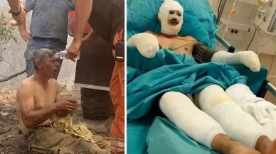 "Yanıyorum" diye feryat etmişti!